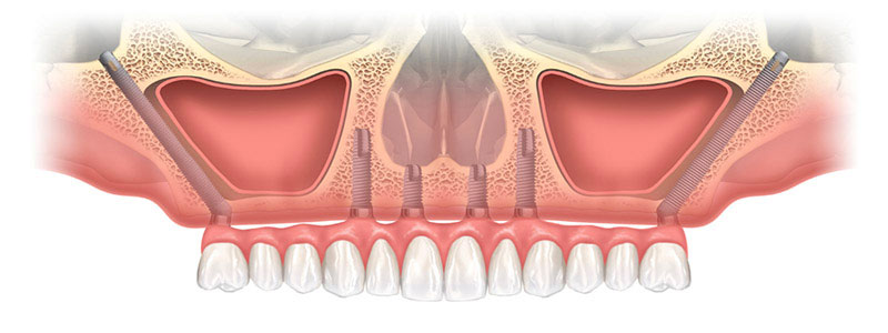 dentiste-bans